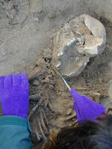 NC90NW0052 Olivia removing right humerus.jpg