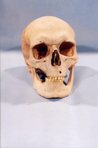 Loth Man - front of skull.JPG