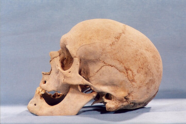 Loth Man - side of skull.JPG